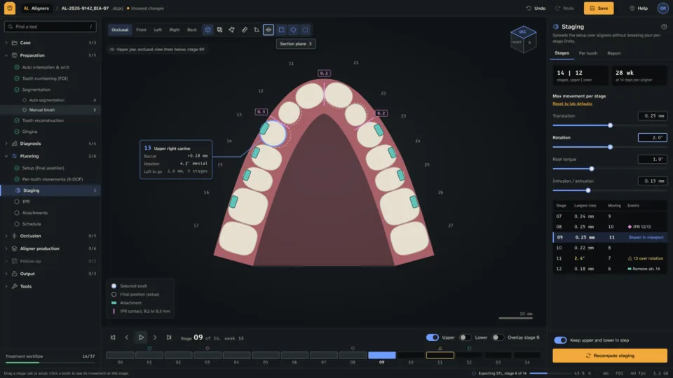 DentalCraft Aligners workspace with a dental scan in the GPU 3D viewport, and the menu groups on the side.